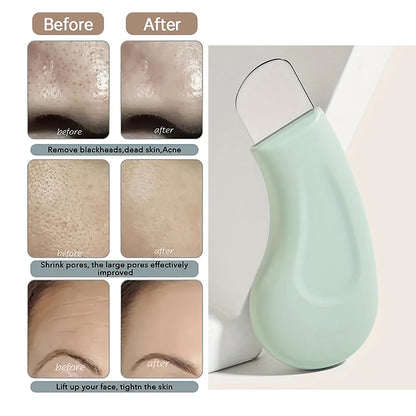 LumaGlow™ Silicone Facial Brush
